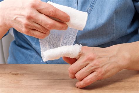 how to know if you finger is broken