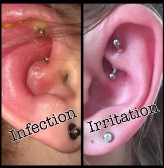 Sinais De Que O Piercing Está Cicatrizando - Cicatrização de Piercing na Orelha: Guia Completo para uma Recuperação ...
