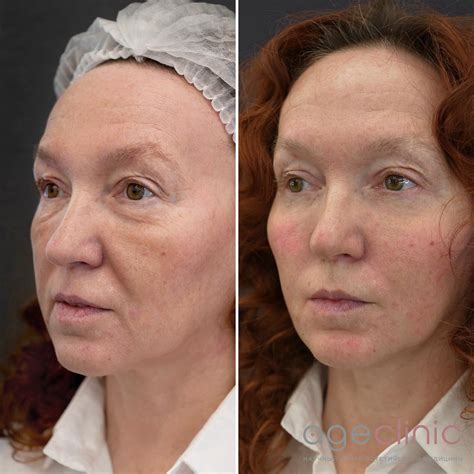 Клиника эстетической медицины и косметологии в Москве | Age Clinic