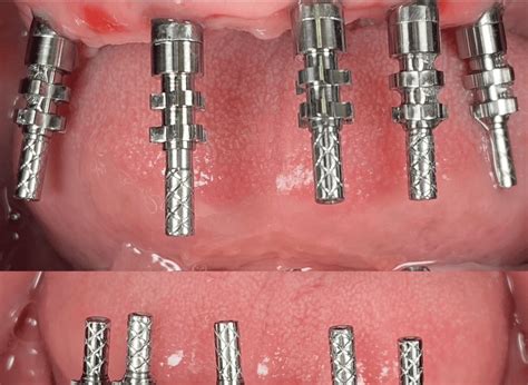 Best Dental Clinic and Dentist in Bali - Kalm Dental Care