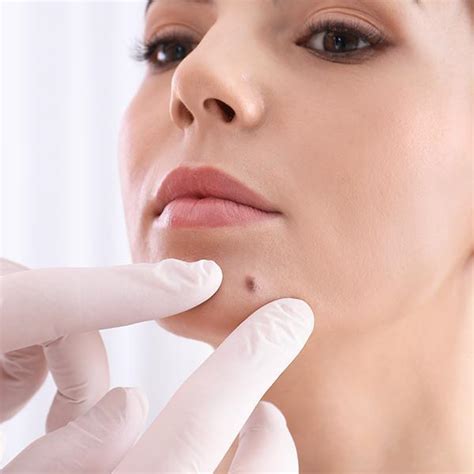 biopsies  davis county centerville  west jordan ut