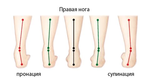 Что такое супинатор и зачем он нужен | Ortofoot