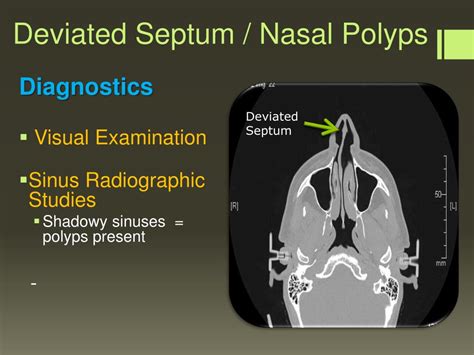 PPT - DISORDERS OF THE UPPER AIRWAY PowerPoint Presentation, free ...