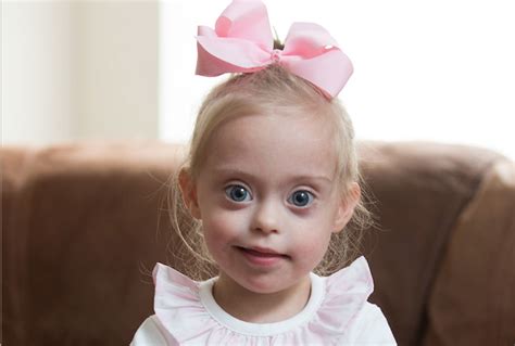 How This 2-Year-Old Model Is Helping to Educate People About Down Syndrome