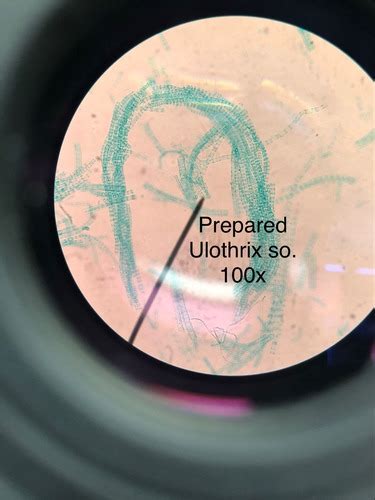 Phylum Chlorophyta; Class Ulvophyceae (Ulothrix) Flashcards | Quizlet