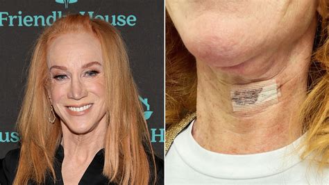 Kathy Griffin undergoes 2nd vocal cord surgery, leaving her unable to speak for 2 weeks | Fox News