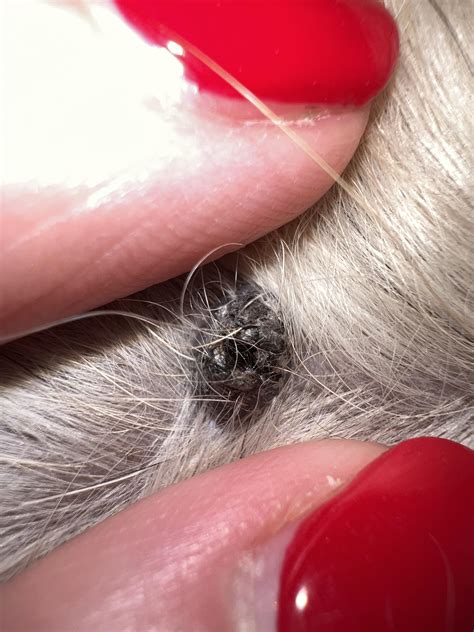 Weird Skin Growths Bumps On The Skin On Your Face: What They Are And