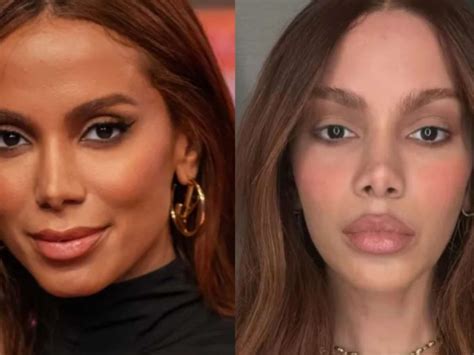Anitta Antes E Depois Plasticas - Anitta Nariz Antes E Depois