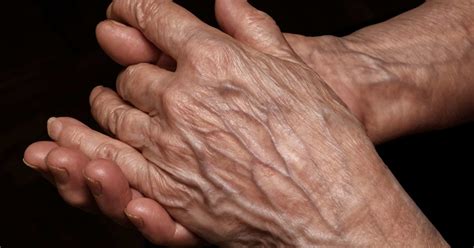Thin skin: Symptoms, causes, and treatment