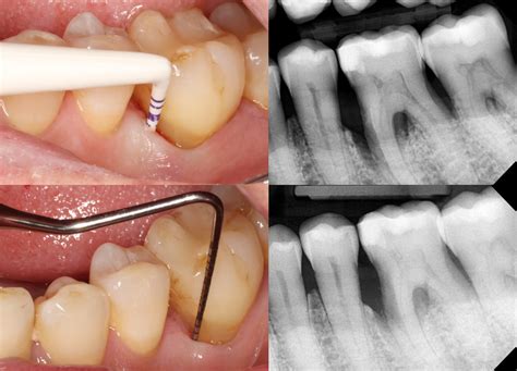 2024-01-12th/13th – Regenerative Therapies in Periodontics – Dental
