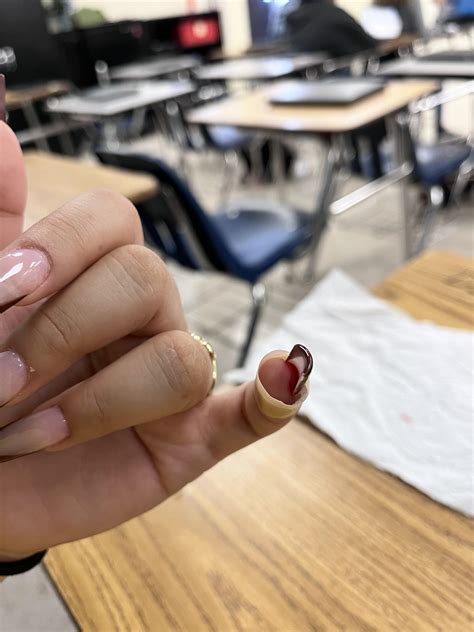 lifted my nail and my natural nail is literally hanging on a thread