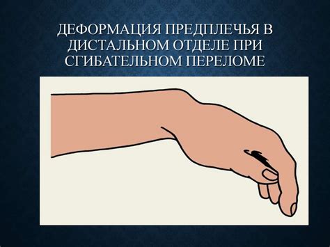 Повреждение костей предплечья - презентация онлайн