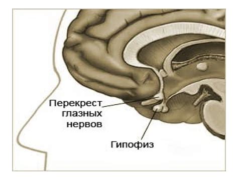 Гиперкортицизм. Синдромының асқынуы - презентация онлайн