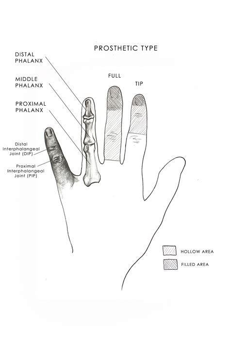 Realistic Alexander Finger Prosthetic