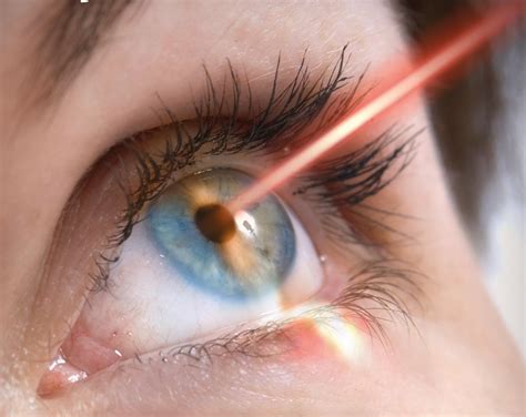 laser eye artofit