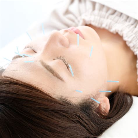 cosmetic acupuncture facial rejuvenation  toronto