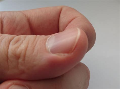 Can You Get Calluses From Playing Piano | INS.