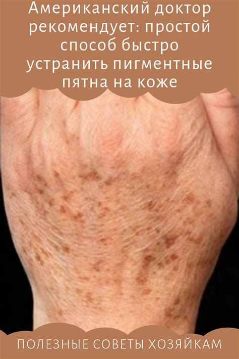 Американский доктор рекомендует: простой способ быстро устранить ...