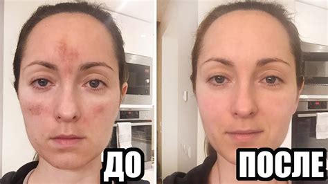 Как удалить пигментные пятна на коже. Полезные советы — Мир интересного