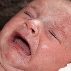Watch For These 5 Signs: Is Your Newborn Formula-Allergic?