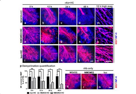 MS#30 and NMO rAb #53 (NMO#53) induce demyelination at different rates ...