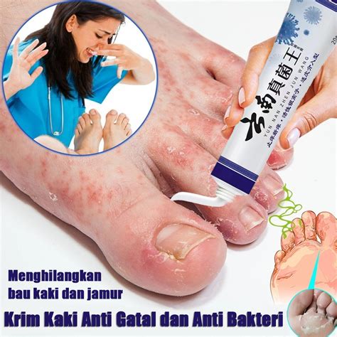 jual obat kaki rayapan  bau yunnan baiyao penghilang bau kaki anti