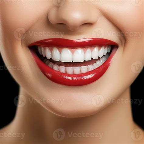 Perfect White Teeth Smile 10 Great Ways To Perfect Smile Zenit Dent
