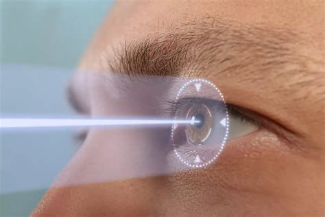 Navigating Laser Eye Surgery Options in the Czech Republic What you ...