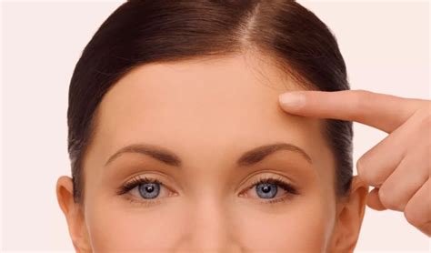 forehead treatments renew skin gungahlin canberra renew skin