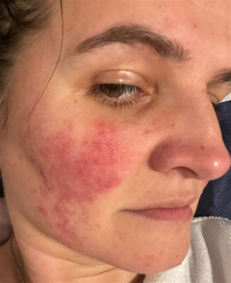 Postpartum Skincare Routine for a Glowing Complexion