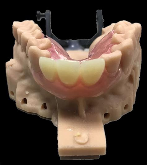 china acrylic denture manufacturers suppliers factory laboratory