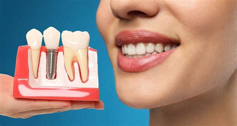 advantages  disadvantages  dental implant dentevim dental clinic