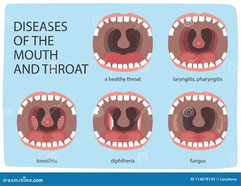 Normal Throat