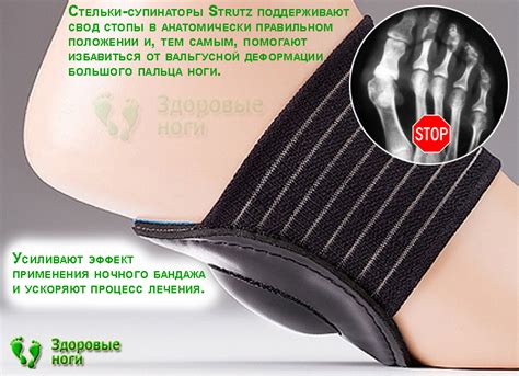 Ортопедические стельки Strutz при поперечном плоскостопии. Купить ...