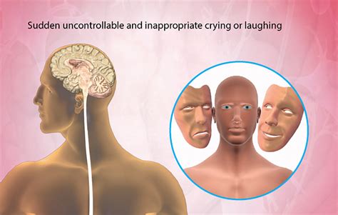 health condition symptoms  treatment