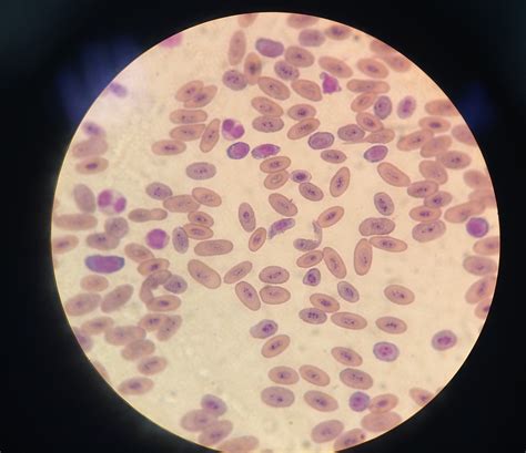 Interpreting avian haematology and biochemistry results - Veterinary
