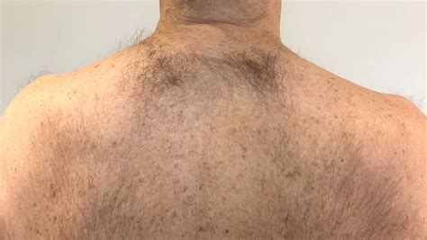 hair removal setsuko beauty  somerset