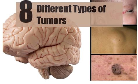 Tumor Meaning