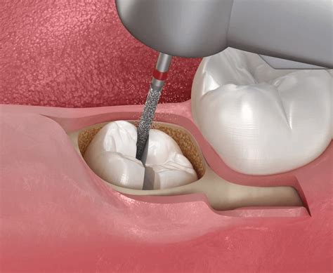 Expert Dental Oral Surgeon | Advanced Oral Surgery Care | 65 Broadway ...