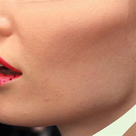Exosome Therapy Is Dermatologists' New Favourite Skin-Rejuvenation ...