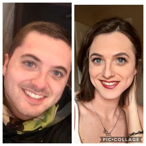 Albums 105+ Pictures Mtf Hrt Before And After Pictures Updated