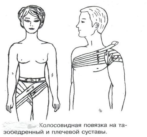 Требования к готовой повязке