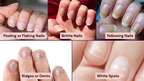 science  nail health      eyecandys