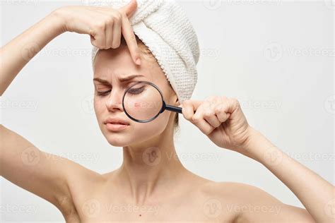 beautiful woman with a pimple on the face hygiene treatment 22467799