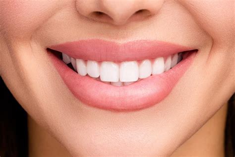 Hollywood Smile - Cinik Dental - Dental Clinic in Turkey 🦷 👄