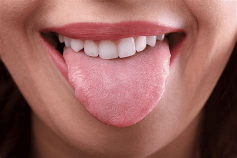 Acidez Na Boca E Na Língua - Acidez Na Boca E Na Língua - FDPLEARN
