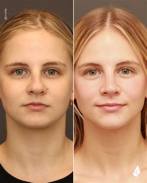 Midwest Facial Plastic Surgery & Face Cosmetic Skincare | Woodbury MN