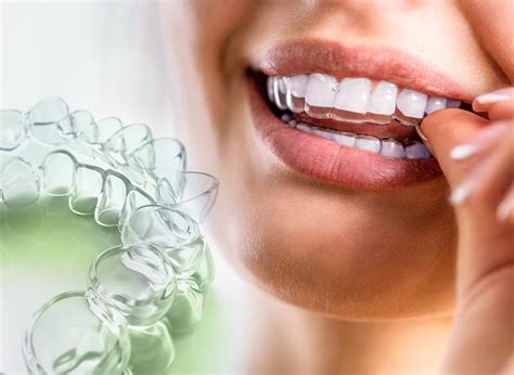 Aligner-Therapie – Zahnarzt Dr. Blatt, Limburg