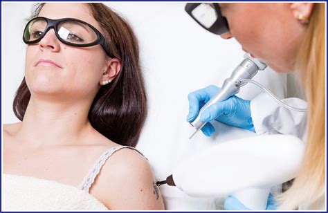 Effective Tattoo Removal Products: A Comprehensive Guide - Hunter Games Magazine