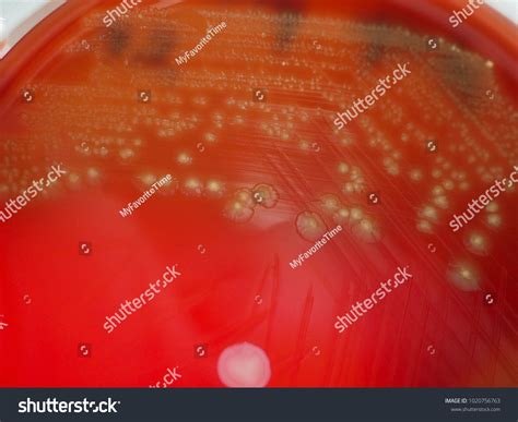 Alpha Hemolysis On Blood Agar Plate ภาพสต็อก 1020756763 | Shutterstock